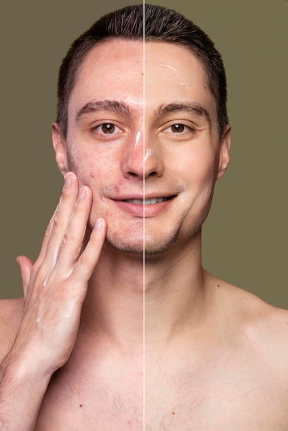 Before and after portrait of young man retouched