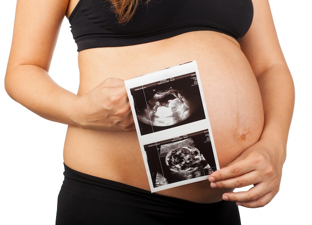 Belly of a pregnant woman with baby's ultrasound Premium Photo