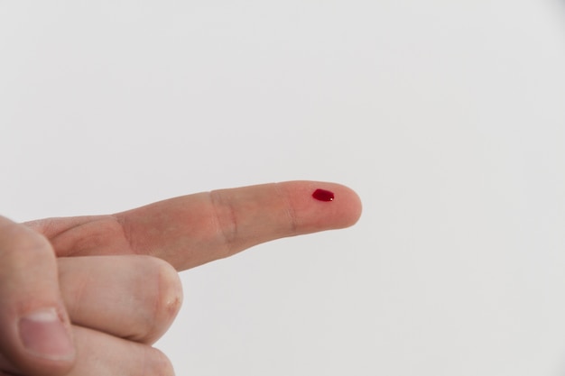 Кровотечение палец