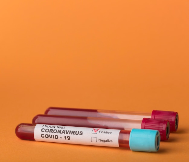 Blood samples assortment on orange