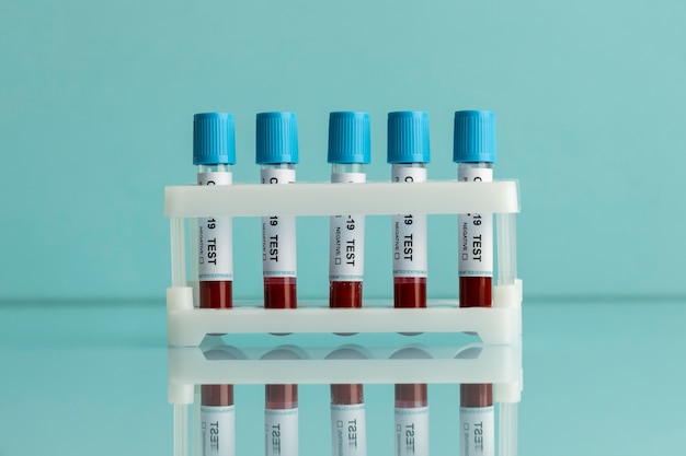 Foto gratuita campioni di sangue per test covid in laboratorio