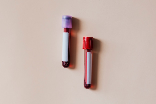 Blood test tubes on a beige surface