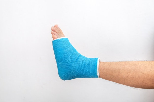 Blue splint ankle. Bandaged leg cast on male patient on white background isolated. Sports injury concept.