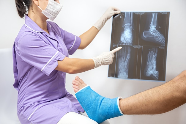 남성 환자의 뼈 골절 발과 다리는 병원에서 여자 의사에 의해 검사되고 있습니다.