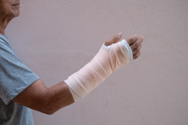 Broken or injued arm in plaster cast or finger joint and numb wrist surgery...