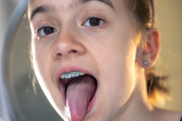 無料写真 鏡を見ている歯に矯正装置を付けた白人の女の子