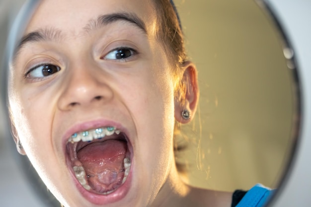 Free photo caucasian preteen girl with braces on her teeth looking at the mirror