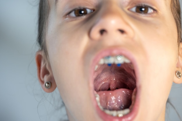 A child girl open her mouth and show her tounge