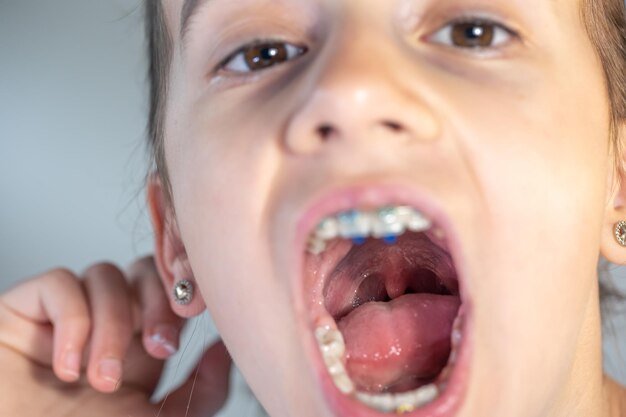 A child girl open her mouth and show her tounge