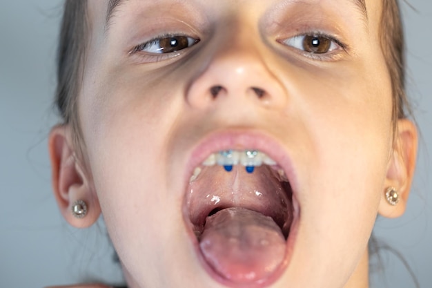 Foto gratuita una bambina apre la bocca e mostra la lingua