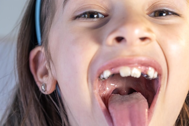 Child during orthodontist visit and oral cavity checkup