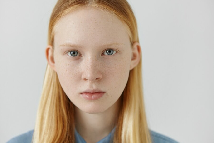 7. Teenager with Blonde Hair and Freckles - wide 4