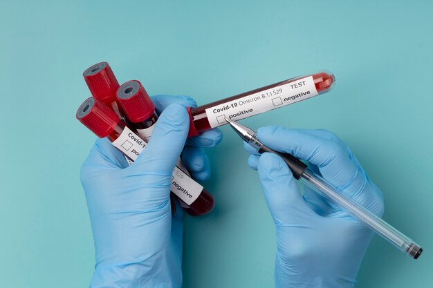 Close up on blood test for omicron