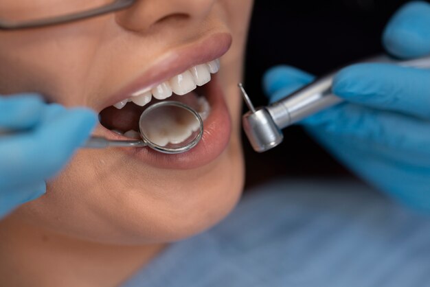 장비 를 사용 하는 치과 의사 의 근접 사진