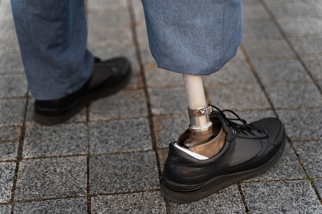 Крупный план инвалида с протезом ноги