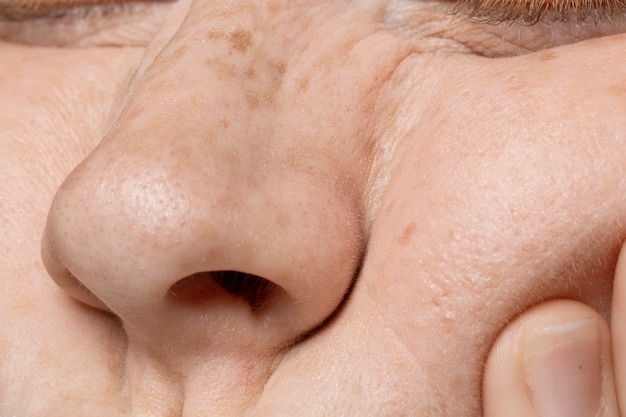 Close up on face pores texture