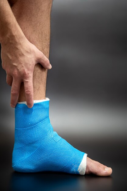 Close up  of foot blue splint for treatment of injuries from ankle sprain.