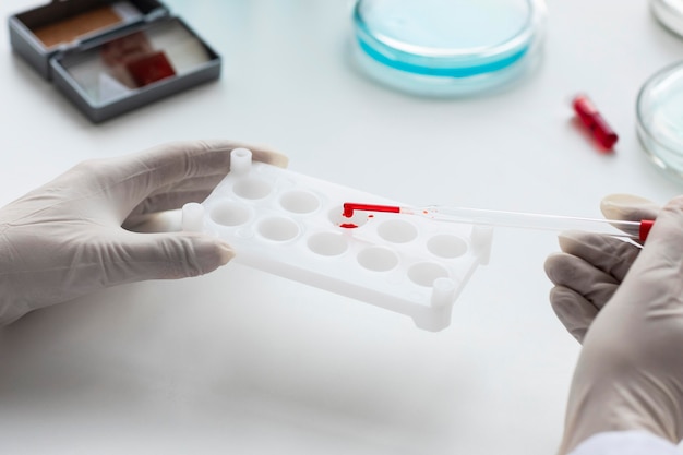 Close up hand with glove holding  pipette