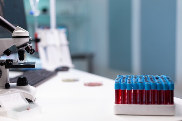 Close up of laboratory desk with professional research equipment. Tray of vacutainers with blood for microscopic examination, micro pipette and microscope. Tools for science development