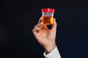 Free photo close up of male's hand holding container with urine sample