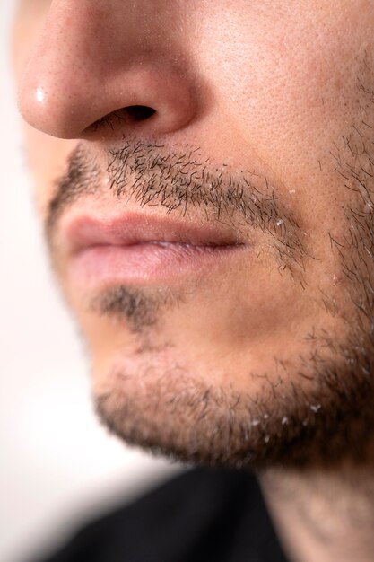 Close up man with dandruff issues