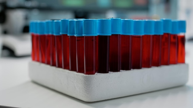 무료 사진 과학 실험실의 의료 트레이에 있는 vacutainers의 혈액 샘플을 닫습니다. 유전자 검사를 위한 빨간색 dna 액체가 있는 투명한 튜브. 유색 바이오 솔루션의 유리 플라스크