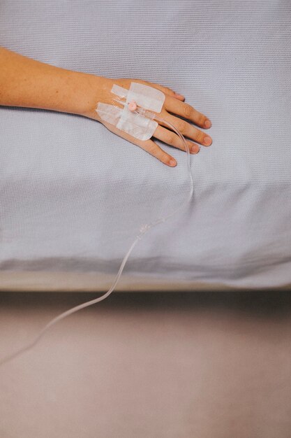 Close up of a patients hand with an IV