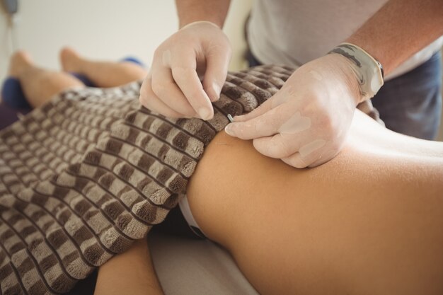 Close-up of physiotherapist performing dry needling on patient