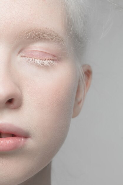 Close up portrait of beautiful albino woman isolated on studio. . Details.