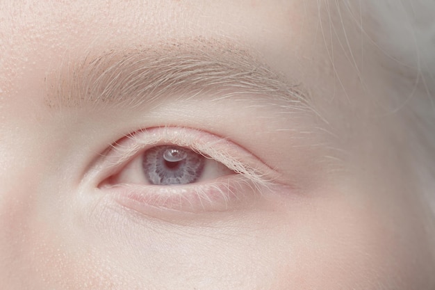 Free photo close up portrait of beautiful albino woman