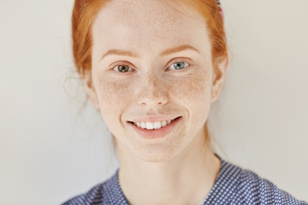 Close up portrait of beautiful young redhead model with different colored eyes and healthy clean skin with freckles smiling joyfully, showing her white teeth, posing indoors. Heterochromia in human