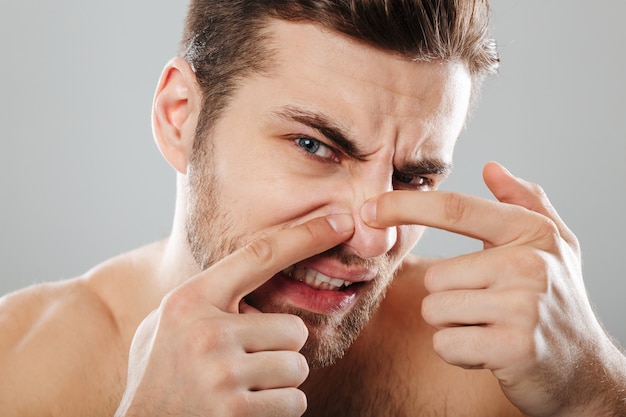 Close up portrait of a man squeezing pimple on his face