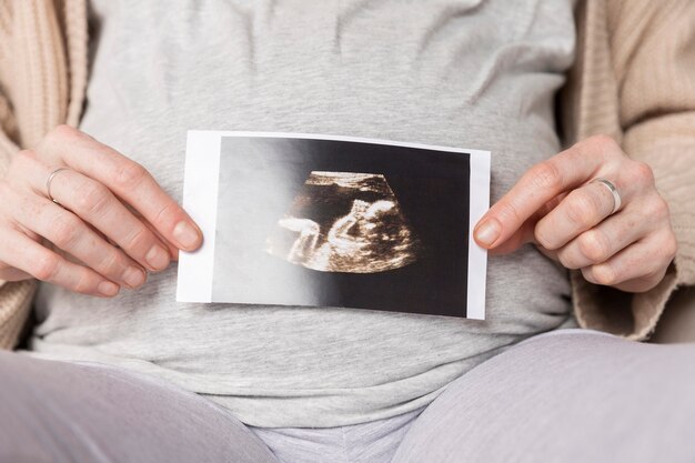 Close-up pregnant woman with ultrasound image