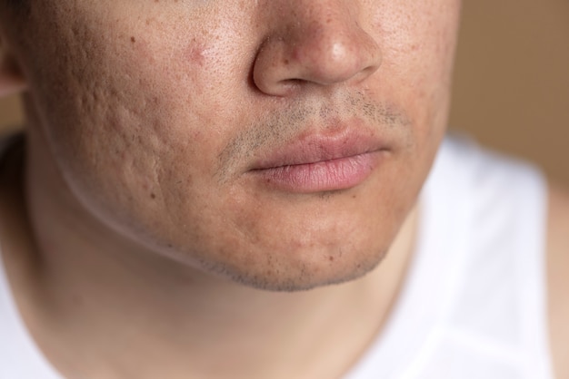 Close up on skin pores during face care routine