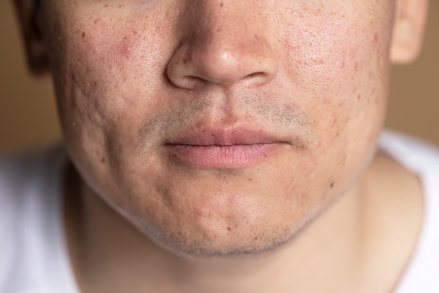 Close up on skin pores during face care routine