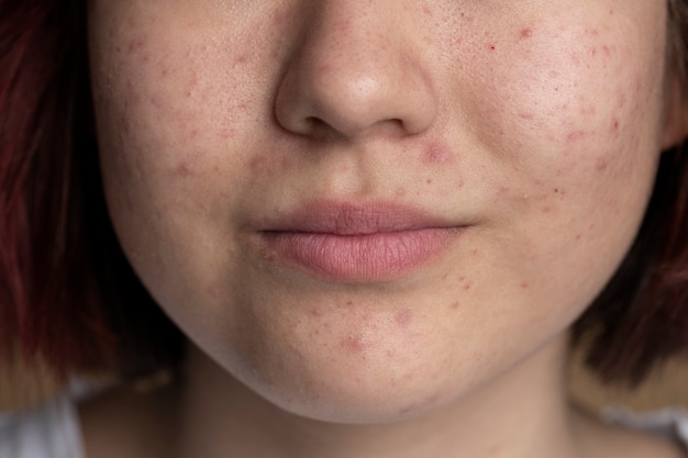 close up on skin pores during face care routine