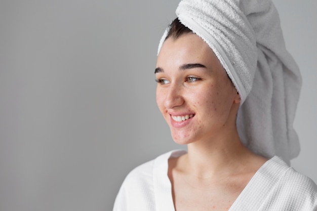 Foto gratuita chiuda sulla donna di smiley con la posa dell'acne