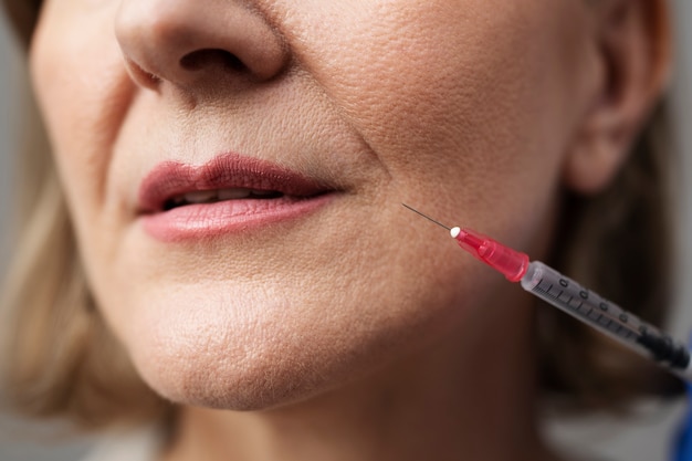 Free photo close up smiley woman with hyaluronic acid injection