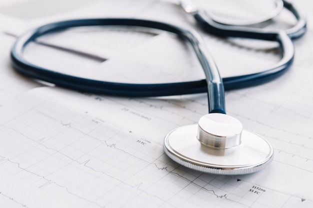 Close-up of a stethoscope on cardiogram chart