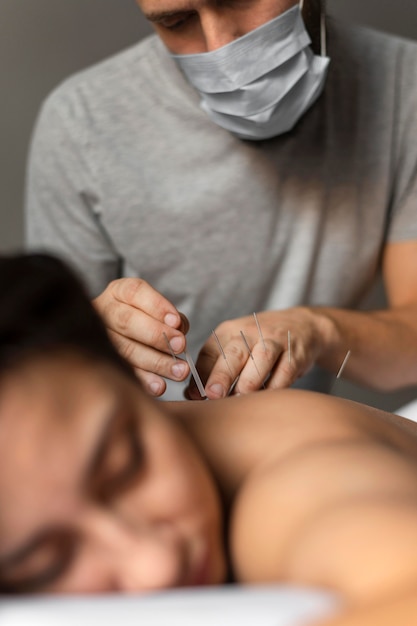 Close-up therapist doing acupuncture