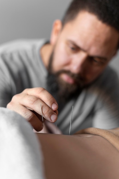 Close-up therapist holding acupuncture needle
