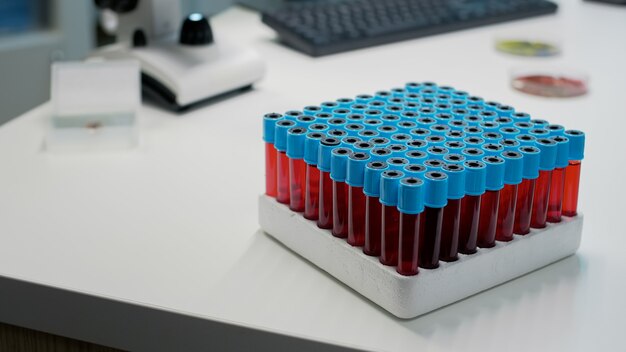 Close up of vacutainers tray with blood on desk