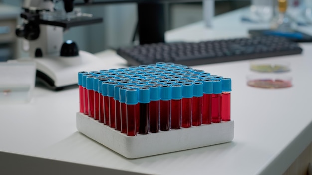 Close up of vacutainers with liquid blood in laboratory on desk. Tray of research test bottles for fluid dna preparing science analysis. Equipment for pharmaceutical development industry