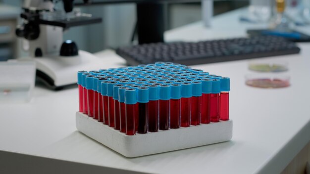 책상에 있는 실험실에서 액체 혈액이 있는 vacutainers의 닫습니다. 과학 분석을 준비하는 유체 dna를 위한 연구 테스트 병 트레이. 의약품 개발 산업용 장비