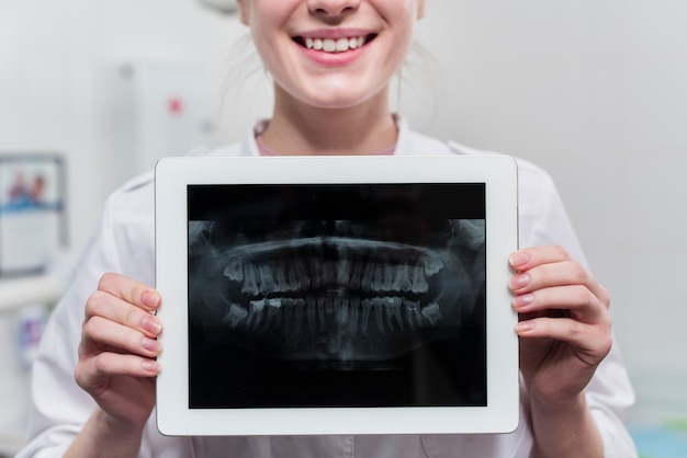 Close-up woman holding teeth x-ray