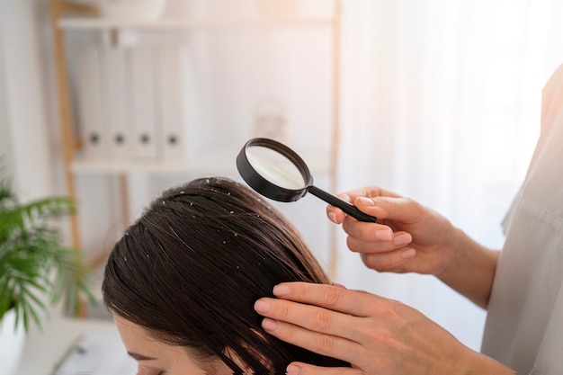 close up woman with dandruff at doctor