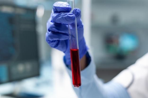 血で透明な試験管を保持している化学者研究者のクローズアップ
