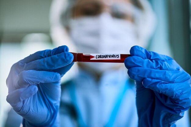 시험관에 코로나바이러스 혈액 샘플을 들고 있는 전염병학자의 근접 촬영