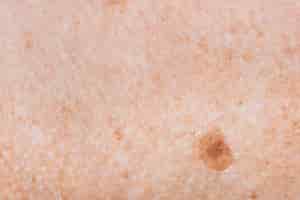 Free photo closeup of freckled skin