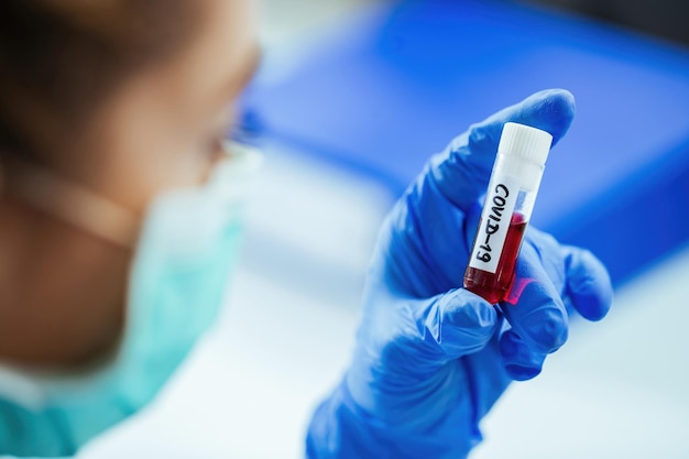 Closeup of laboratory technician with coronavirus blood test sample